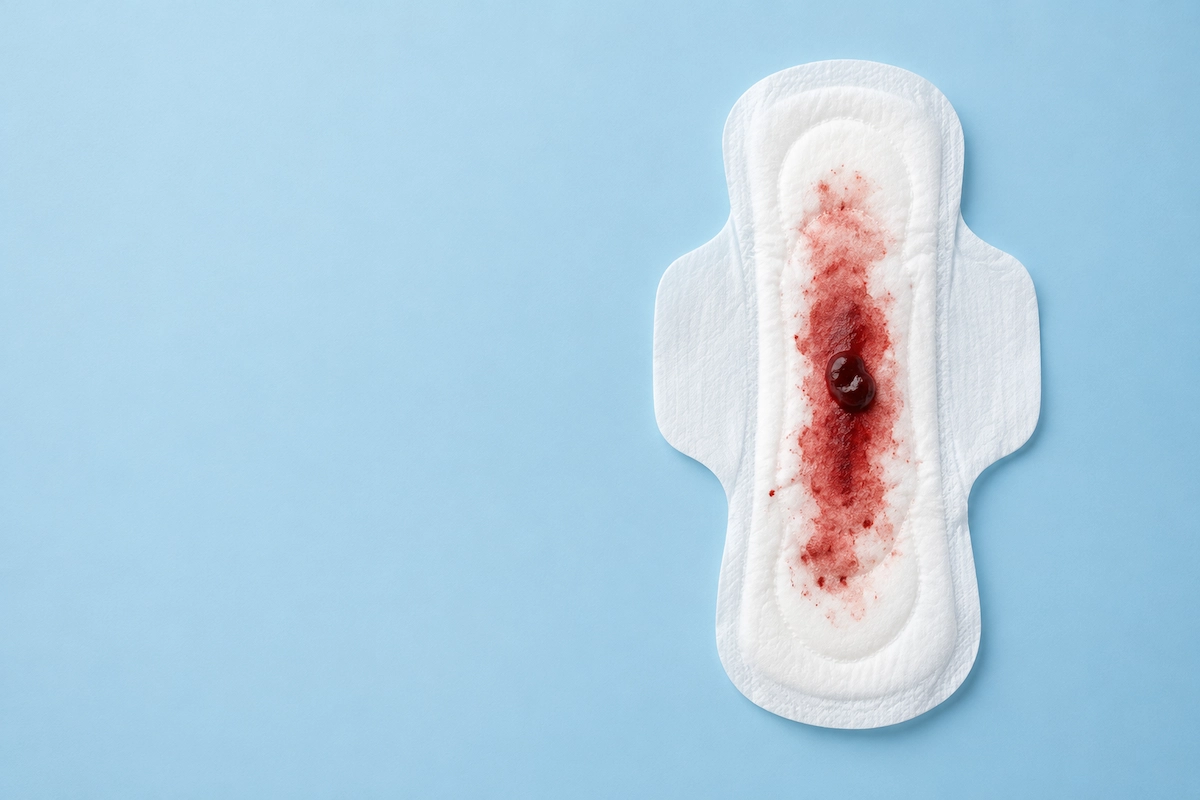 Menstruação com muitos coágulos é normal
